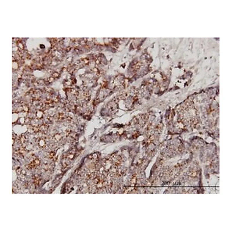 Merck MONOCLONAL ANTI-GBA