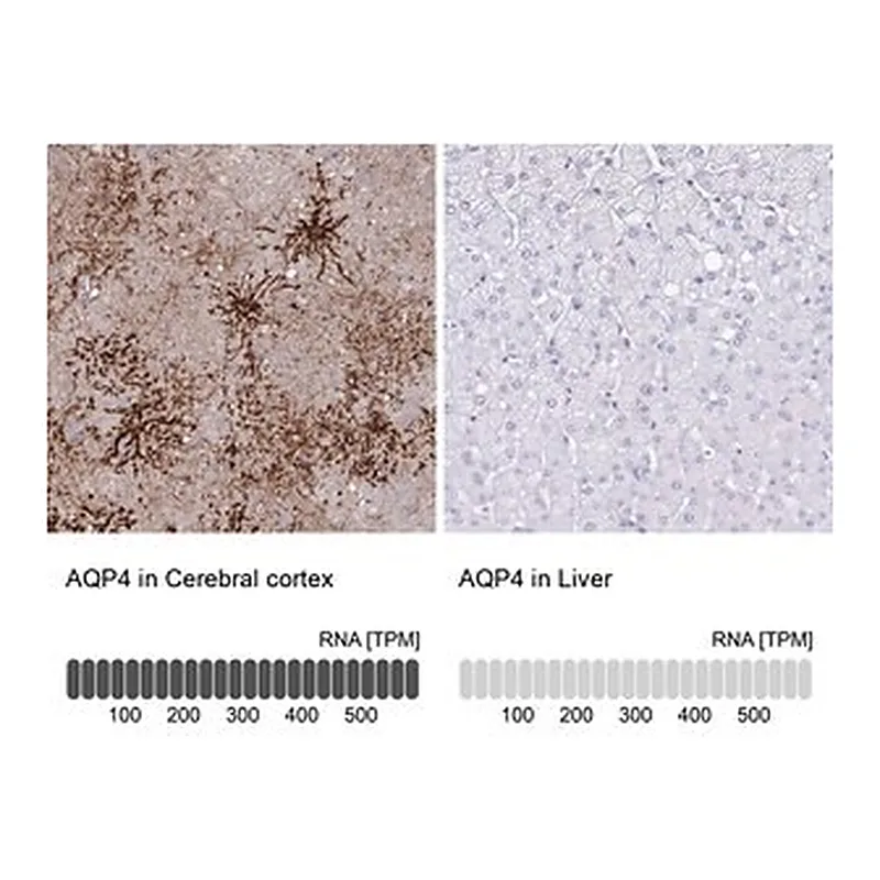 Merck ANTI-AQP4