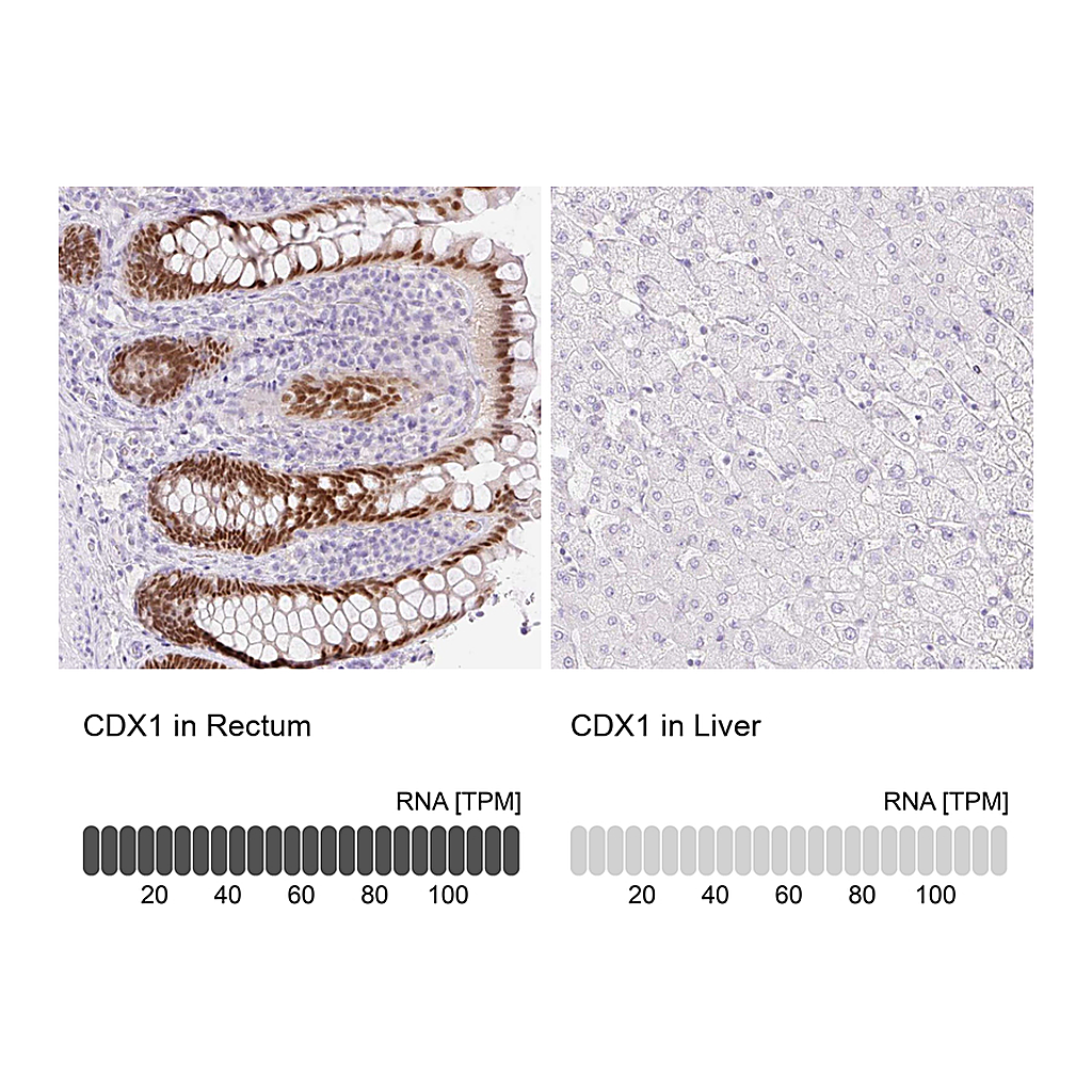 Atlas Antibodies Anti-CDX1 Antibody