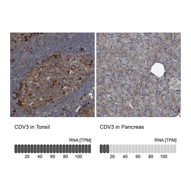 Atlas Antibodies Anti-CDV3 Antibody