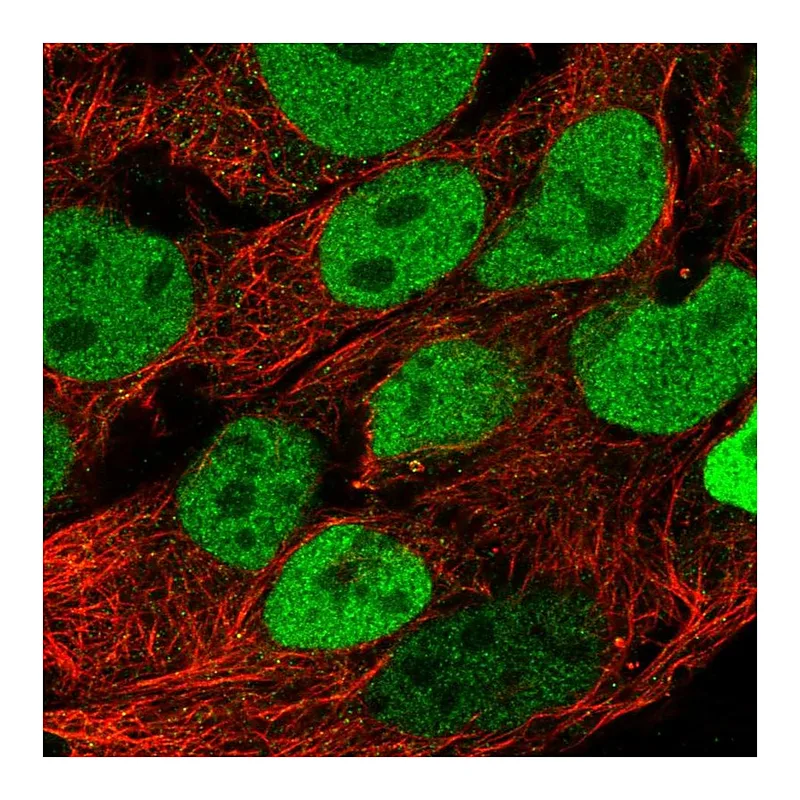 Atlas Antibodies Anti-CDX2 Antibody