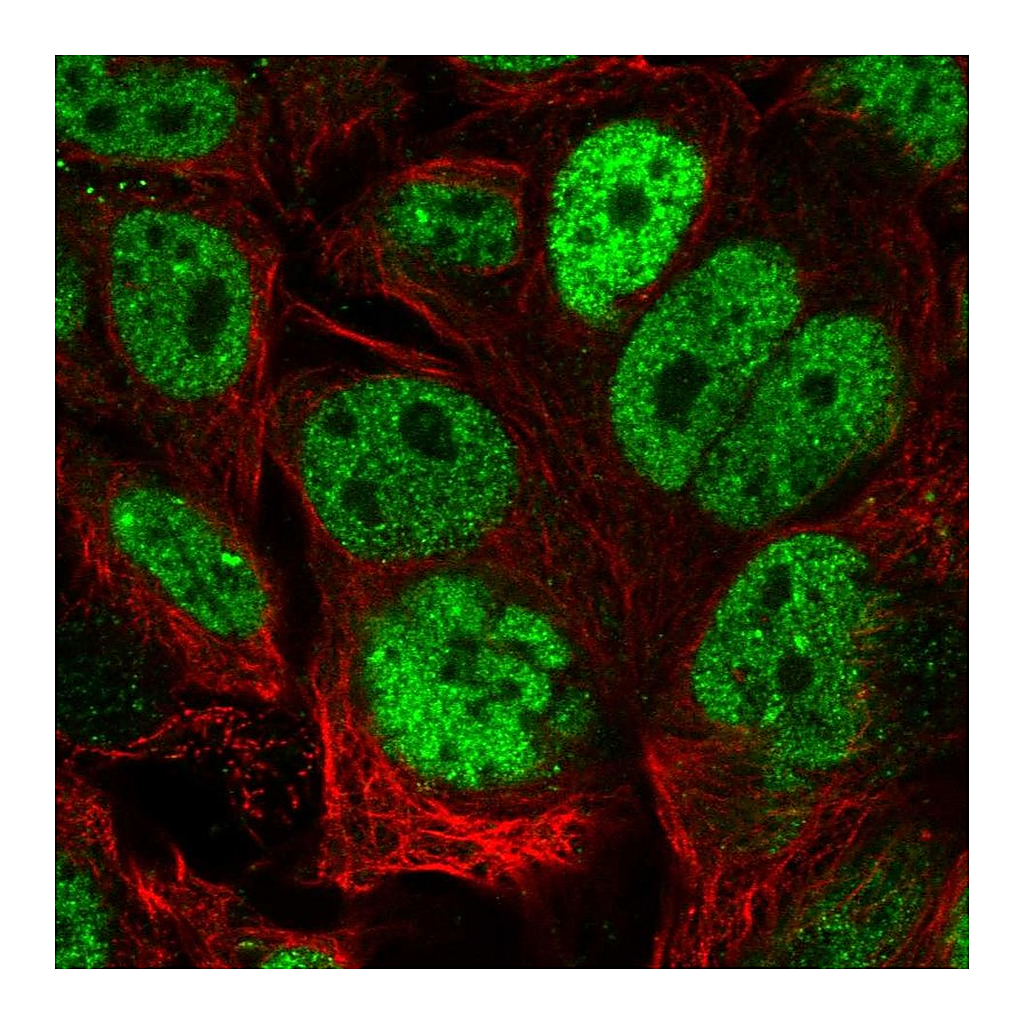 Atlas Antibodies Anti-CDX2 Antibody