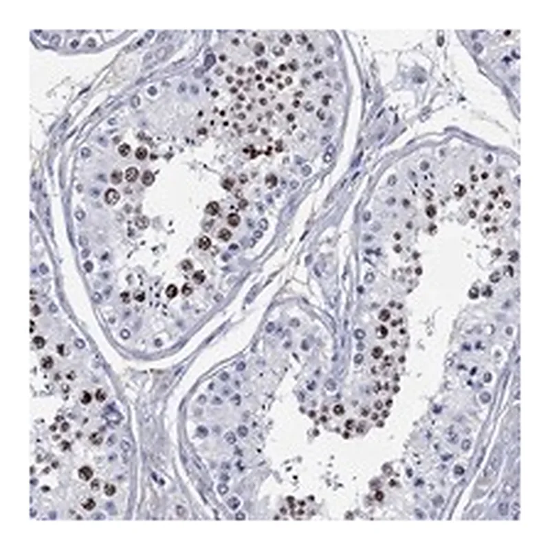Atlas Antibodies Anti-CDY2B Antibody