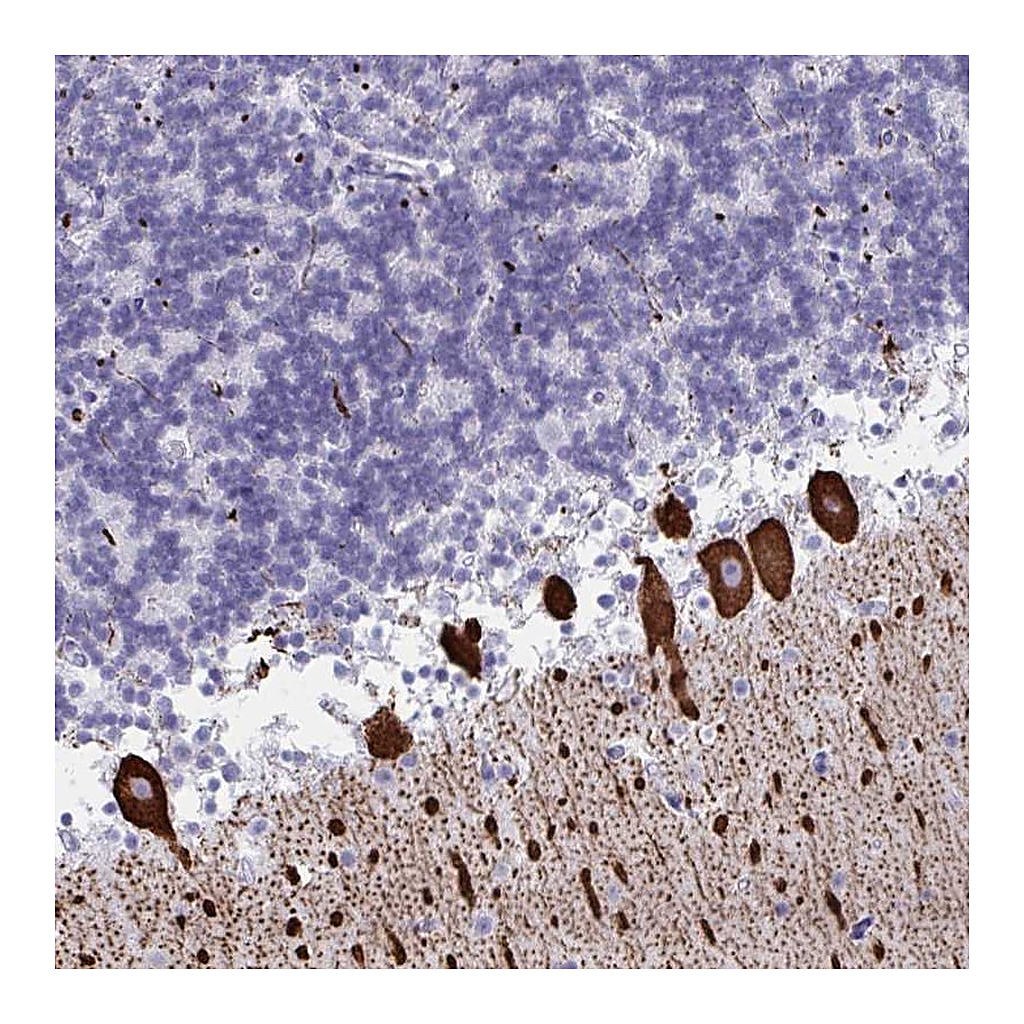 Atlas Antibodies Anti-CDX4 Antibody
