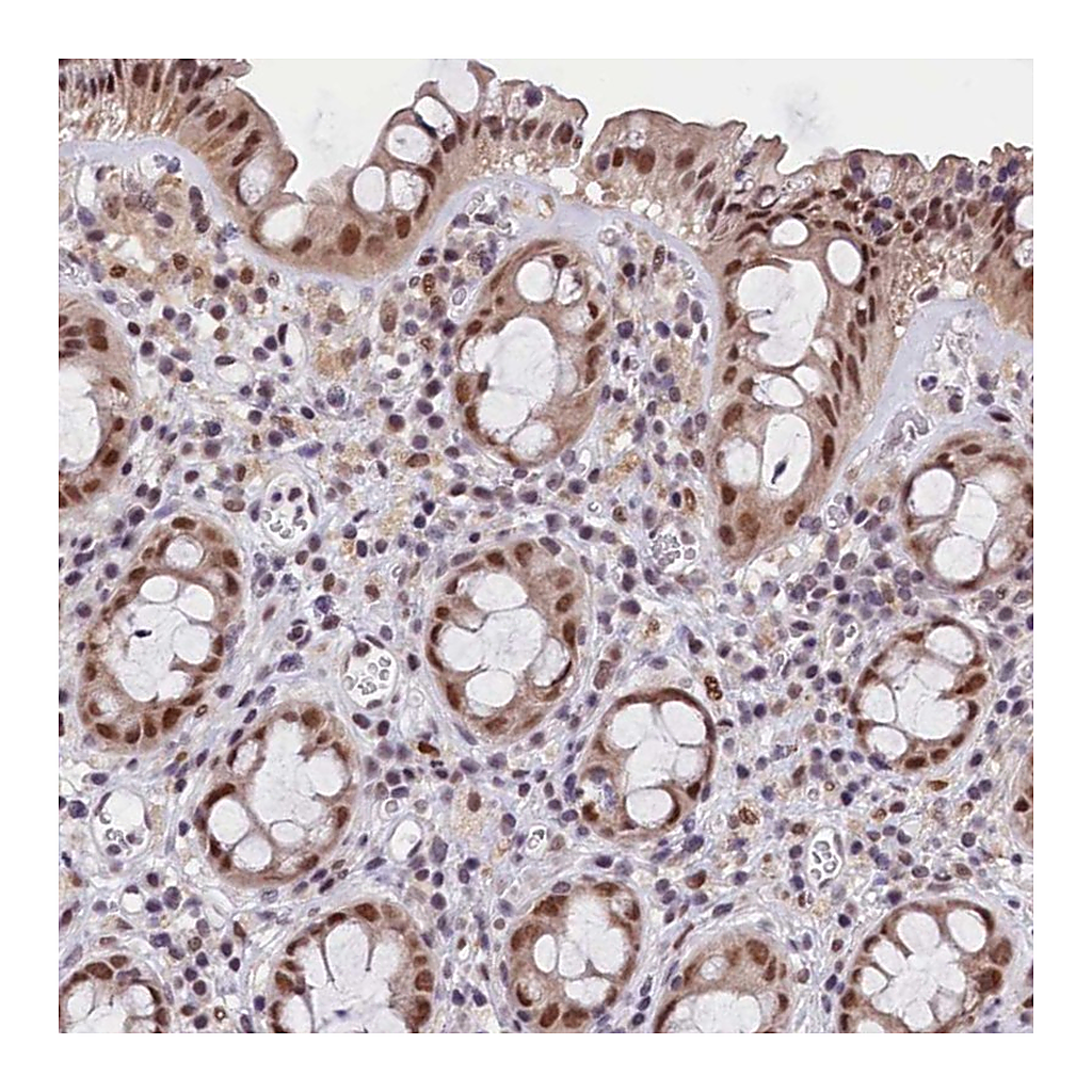 Atlas Antibodies Anti-CDYL2 Antibody