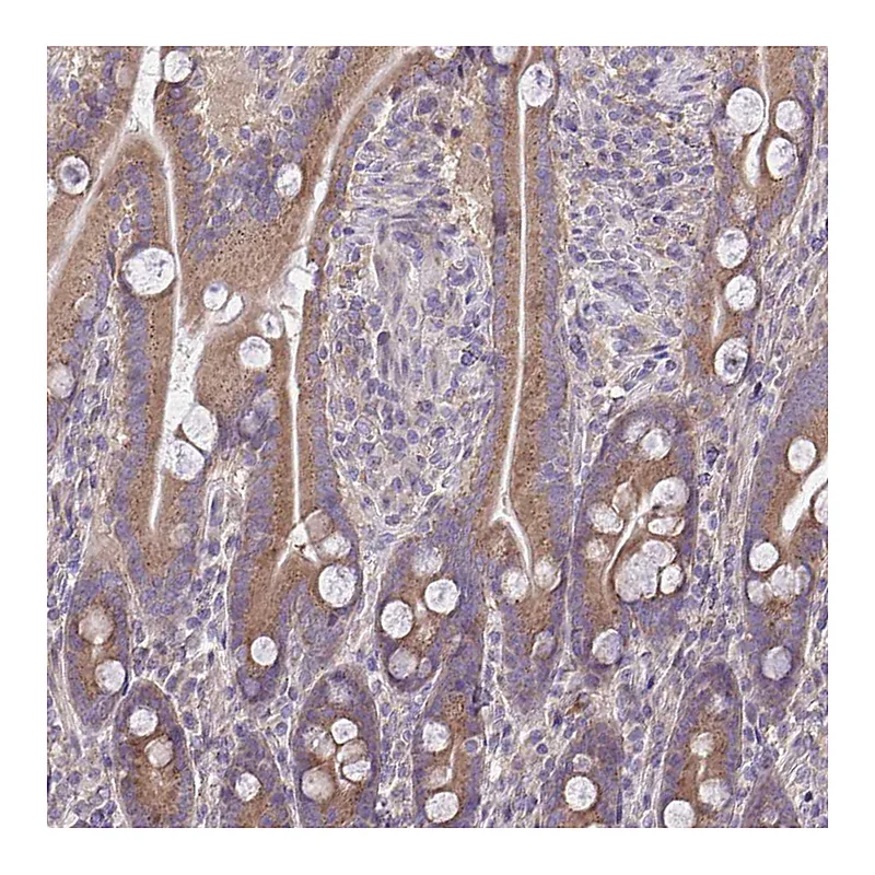 Atlas Antibodies Anti-CEACAM18 Antibody