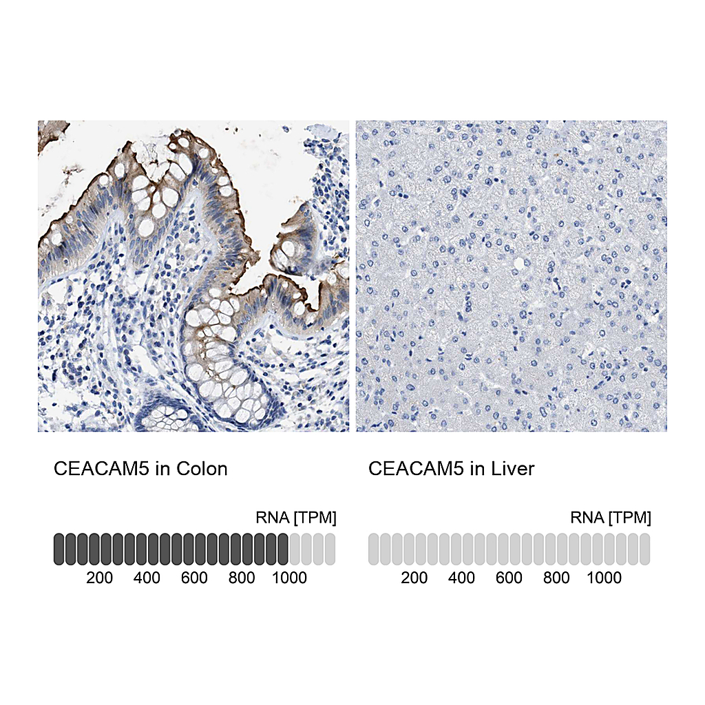 Atlas Antibodies Anti-CEACAM5 Antibody