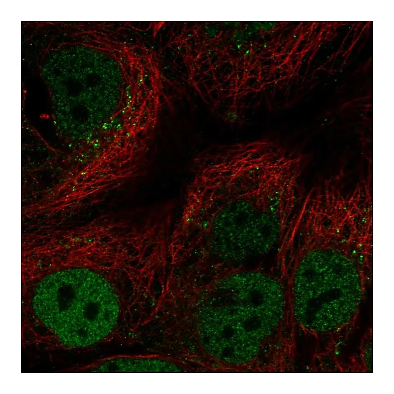 Atlas Antibodies Anti-CEBPA Antibody
