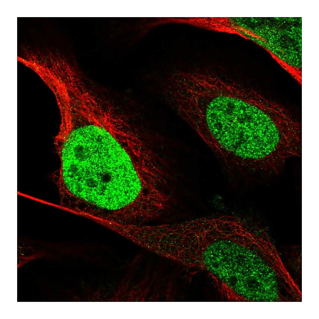 Atlas Antibodies Anti-CEBPB Antibody