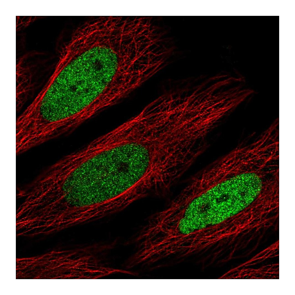 Atlas Antibodies Anti-CEBPD Antibody