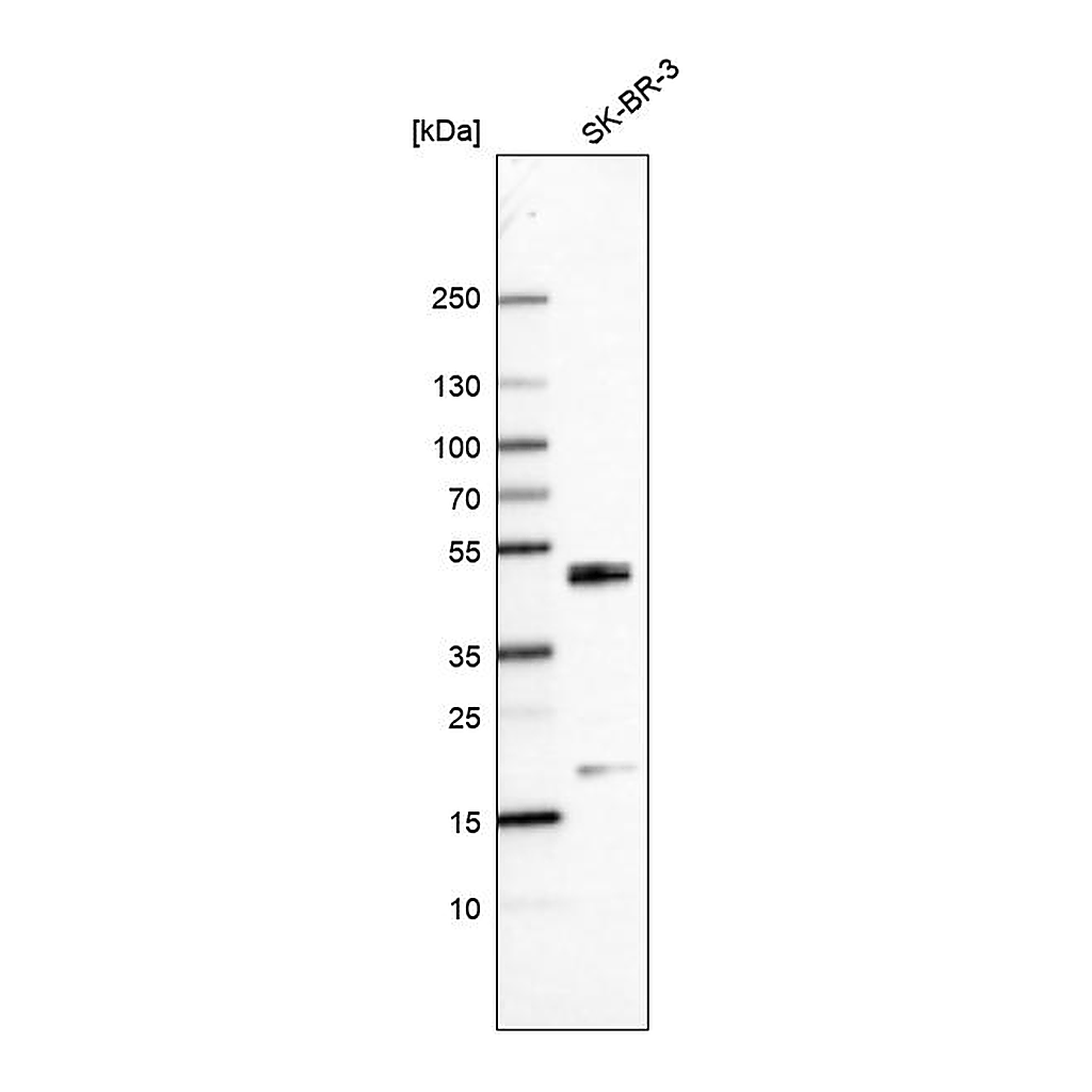 Atlas Antibodies Anti-CEBPB Antibody
