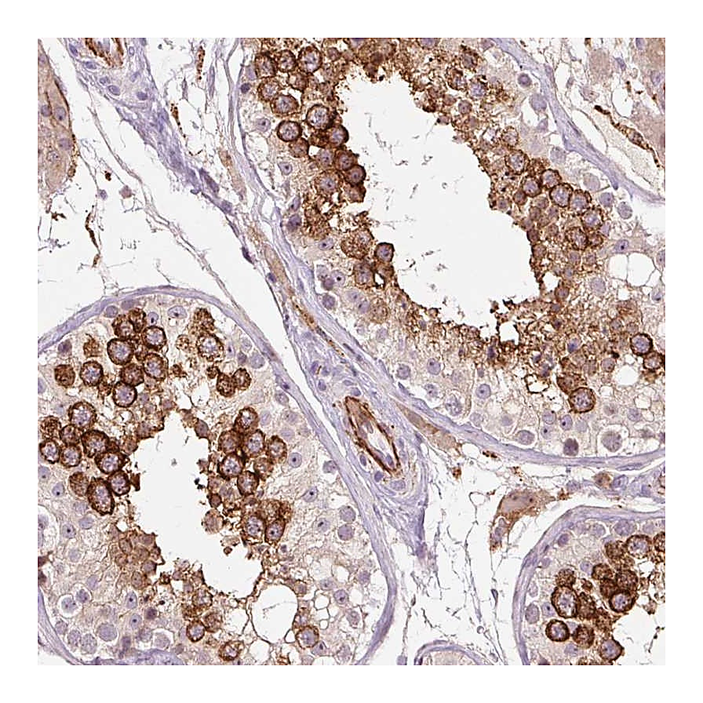 Atlas Antibodies Anti-CEBPZ Antibody