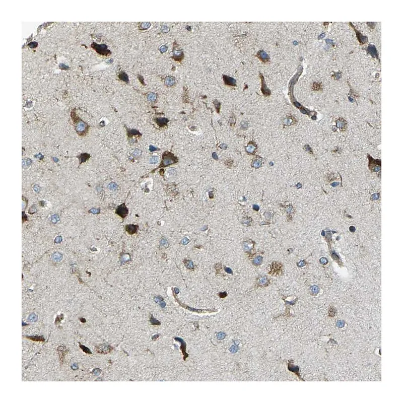 Atlas Antibodies Anti-CELSR2 Antibody