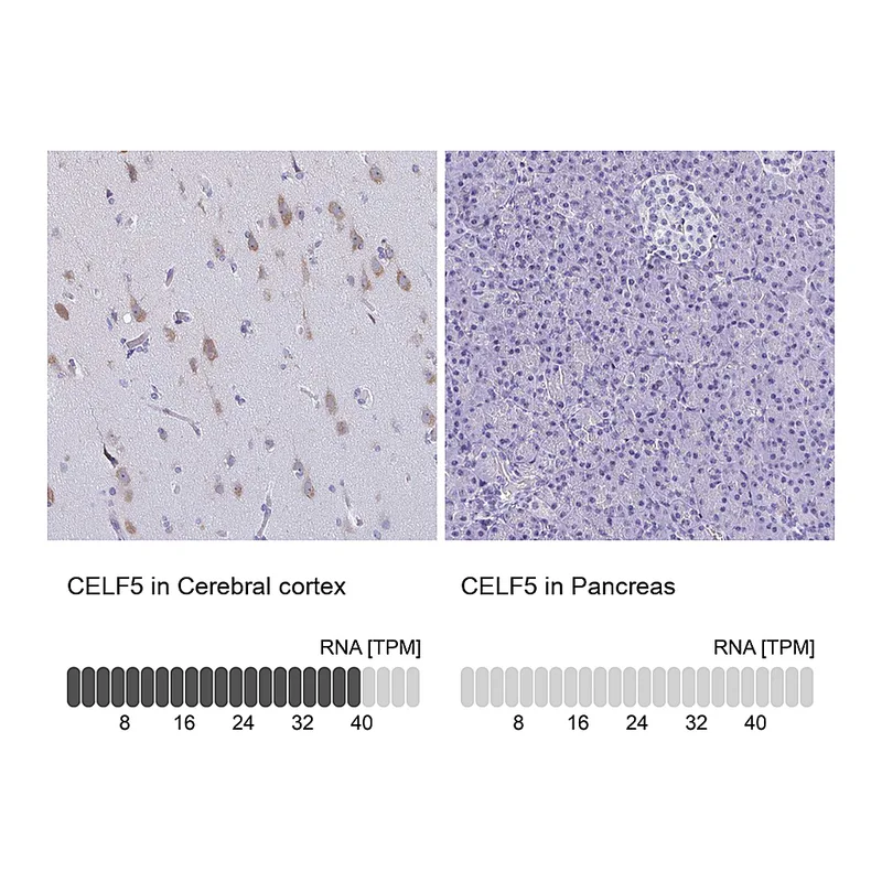 Atlas Antibodies Anti-CELF5 Antibody