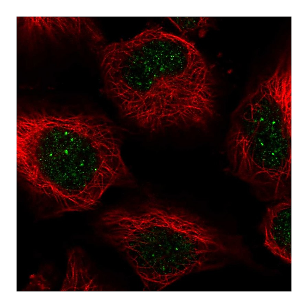 Atlas Antibodies Anti-CENPB Antibody