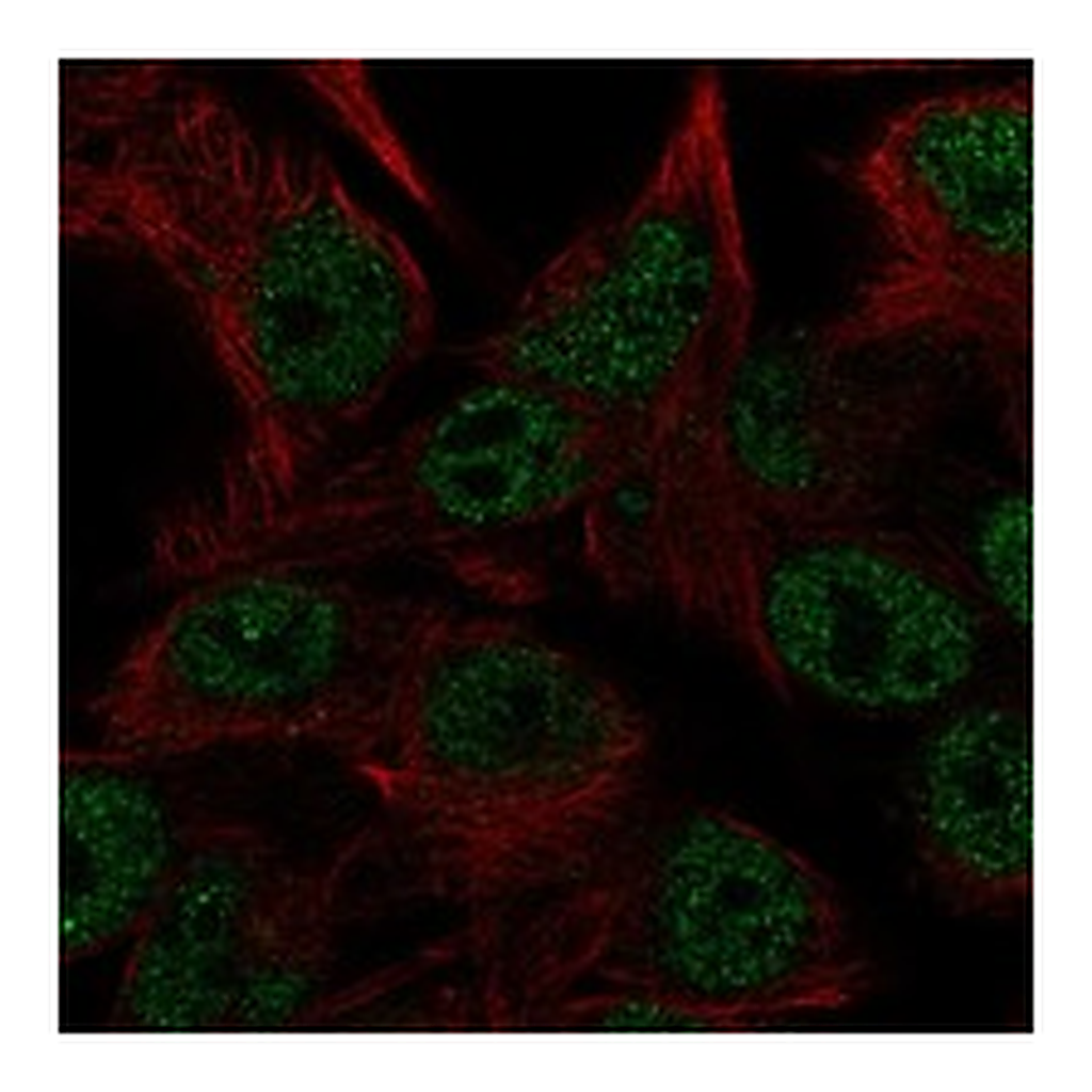 Atlas Antibodies Anti-CEMP1 Antibody