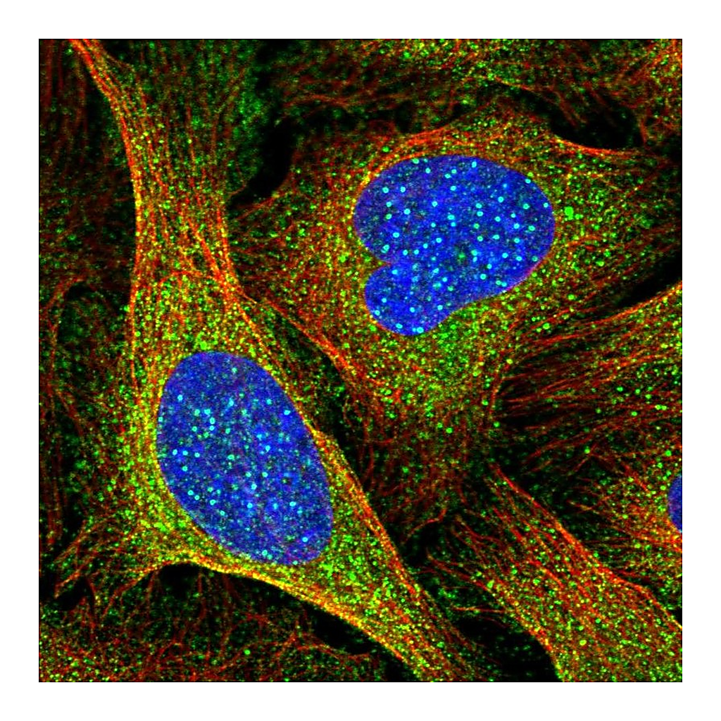 Atlas Antibodies Anti-CENPI Antibody