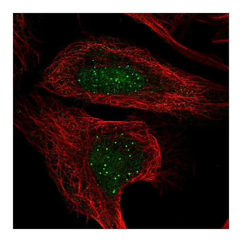 Atlas Antibodies Anti-CENPT Antibody