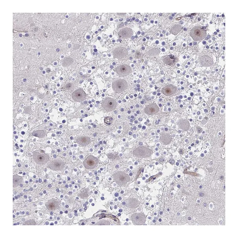 Atlas Antibodies Anti-CENPQ Antibody