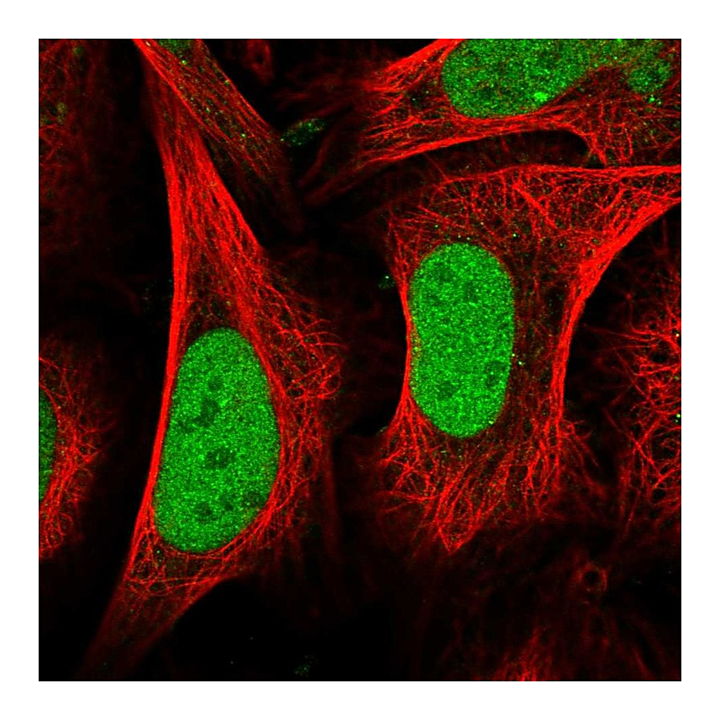 Atlas Antibodies Anti-CENPQ Antibody