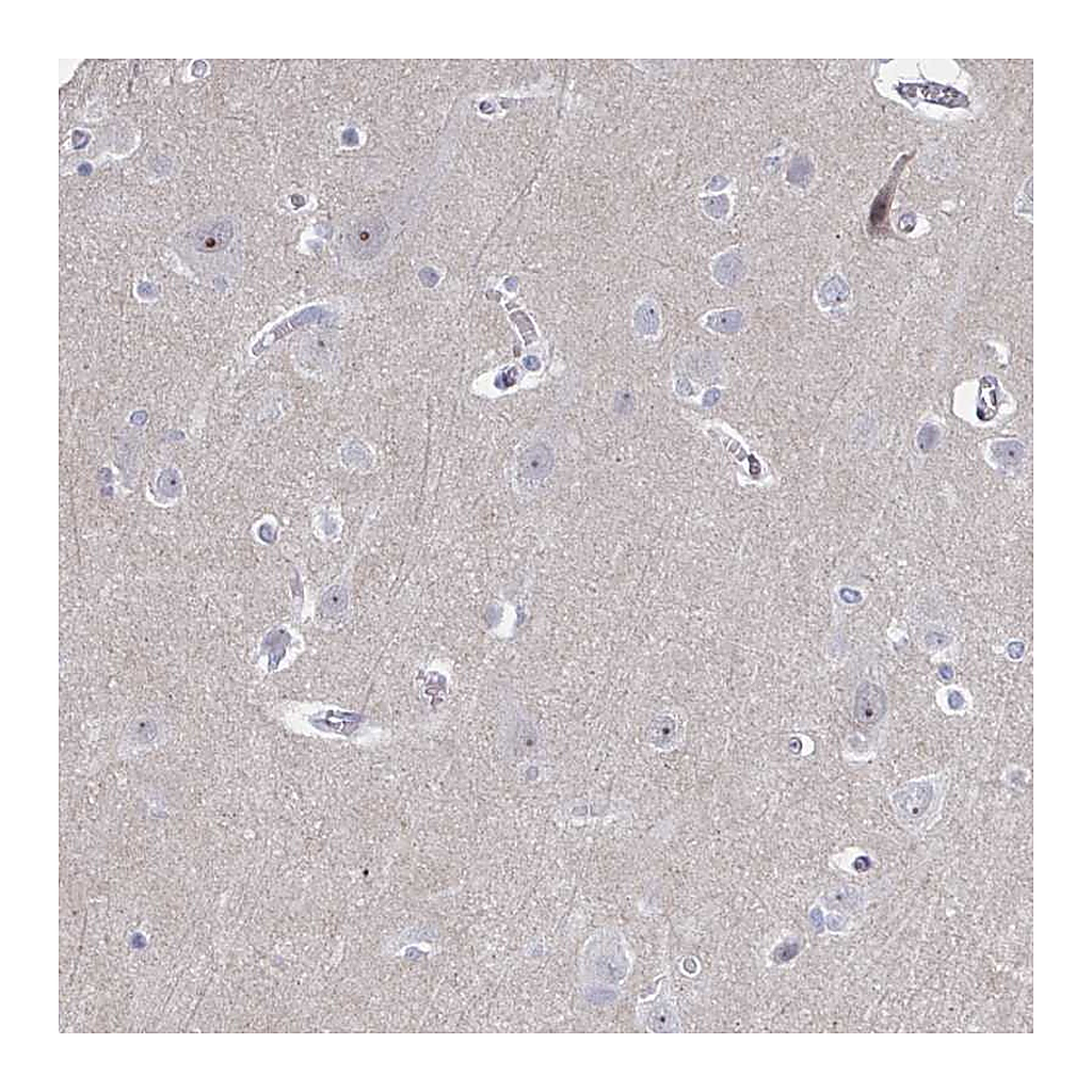 Atlas Antibodies Anti-CENPT Antibody