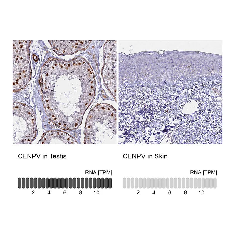 Atlas Antibodies Anti-CENPV Antibody