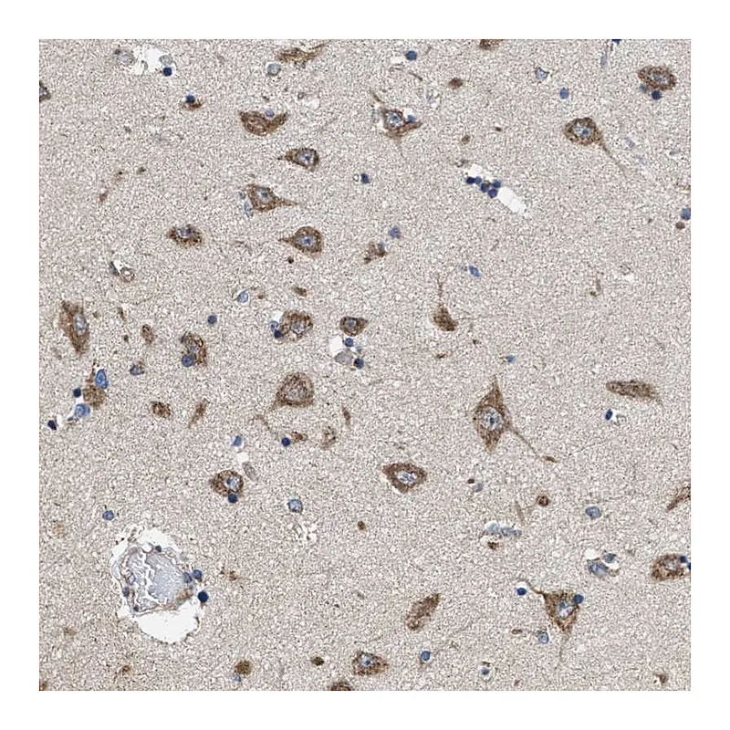 Atlas Antibodies Anti-CEP128 Antibody