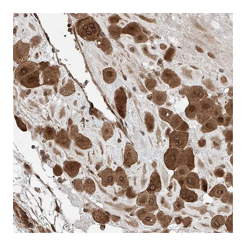 Atlas Antibodies Anti-CEP162 Antibody