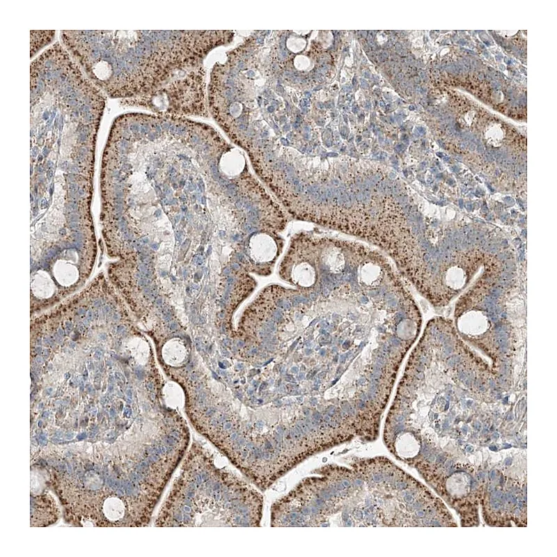 Atlas Antibodies Anti-CEP162 Antibody