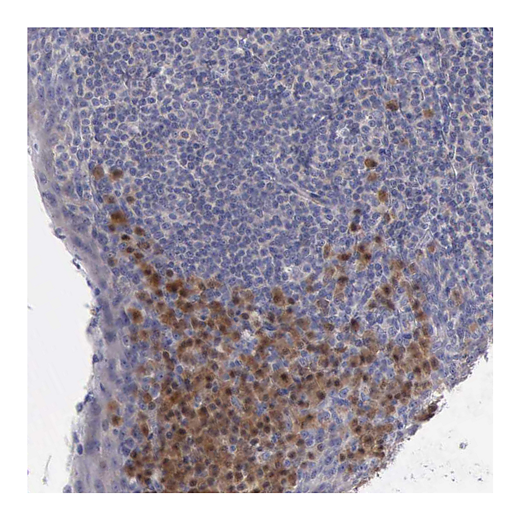 Atlas Antibodies Anti-CEP128 Antibody