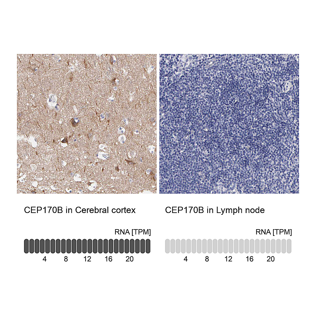 Atlas Antibodies Anti-CEP170B Antibody