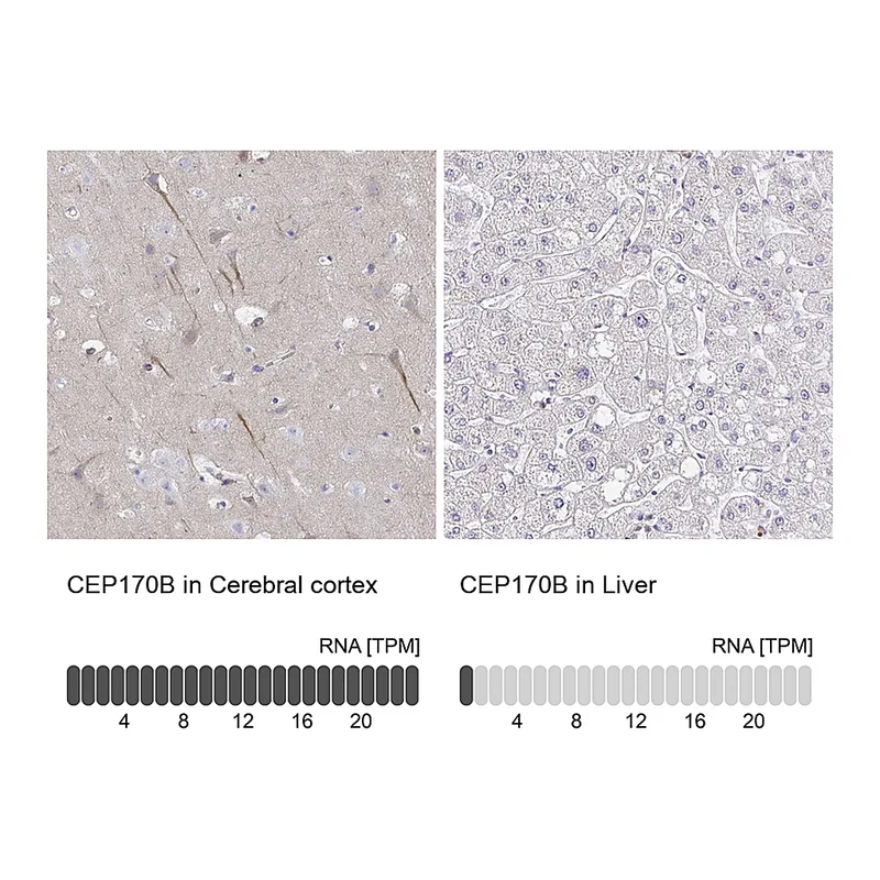 Atlas Antibodies Anti-CEP170B Antibody