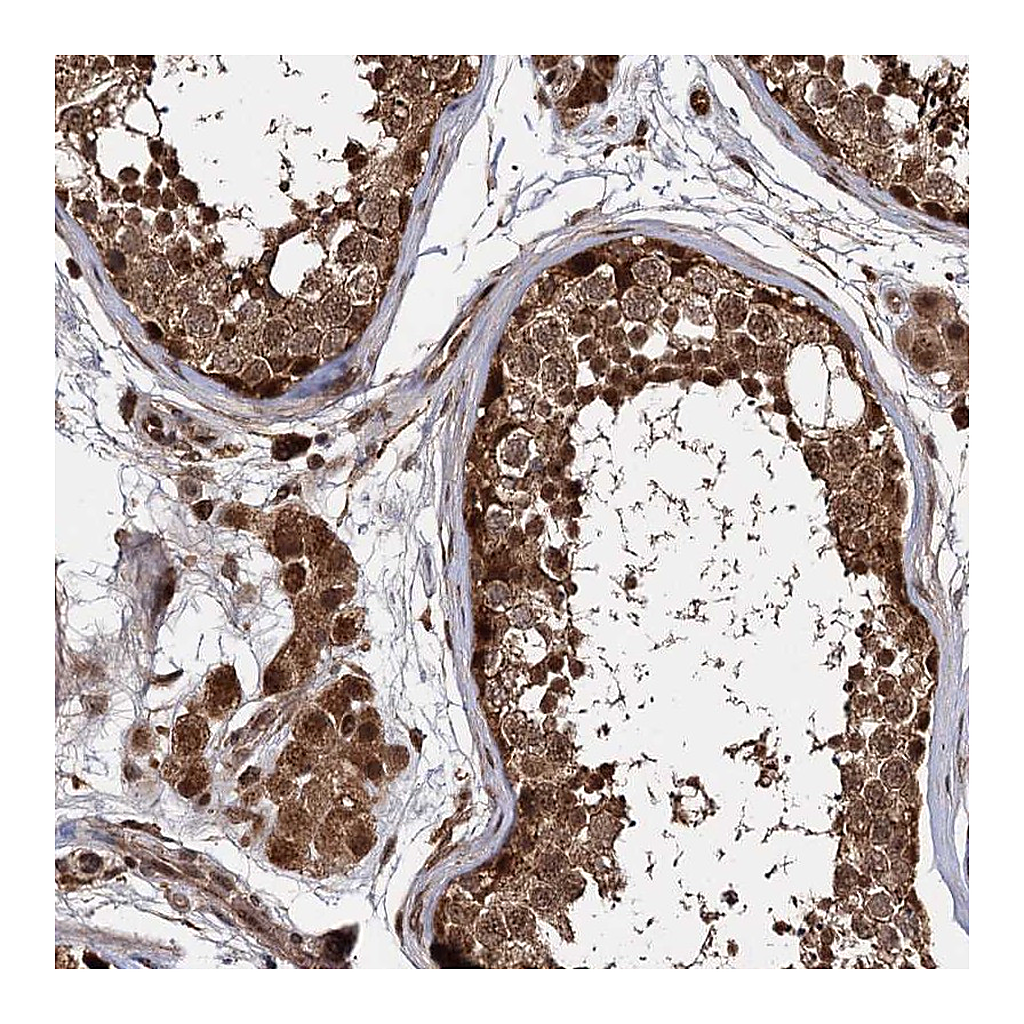 Atlas Antibodies Anti-CEP192 Antibody