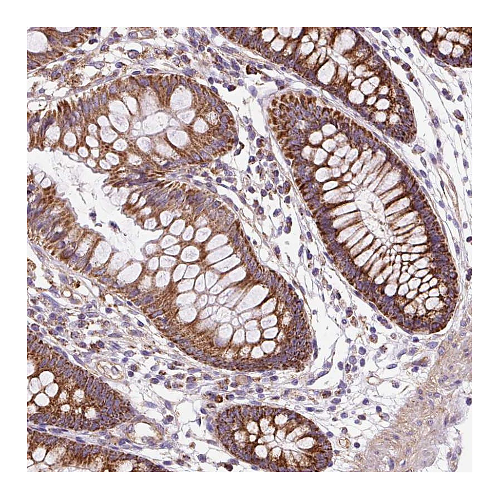 Atlas Antibodies Anti-CEP290 Antibody