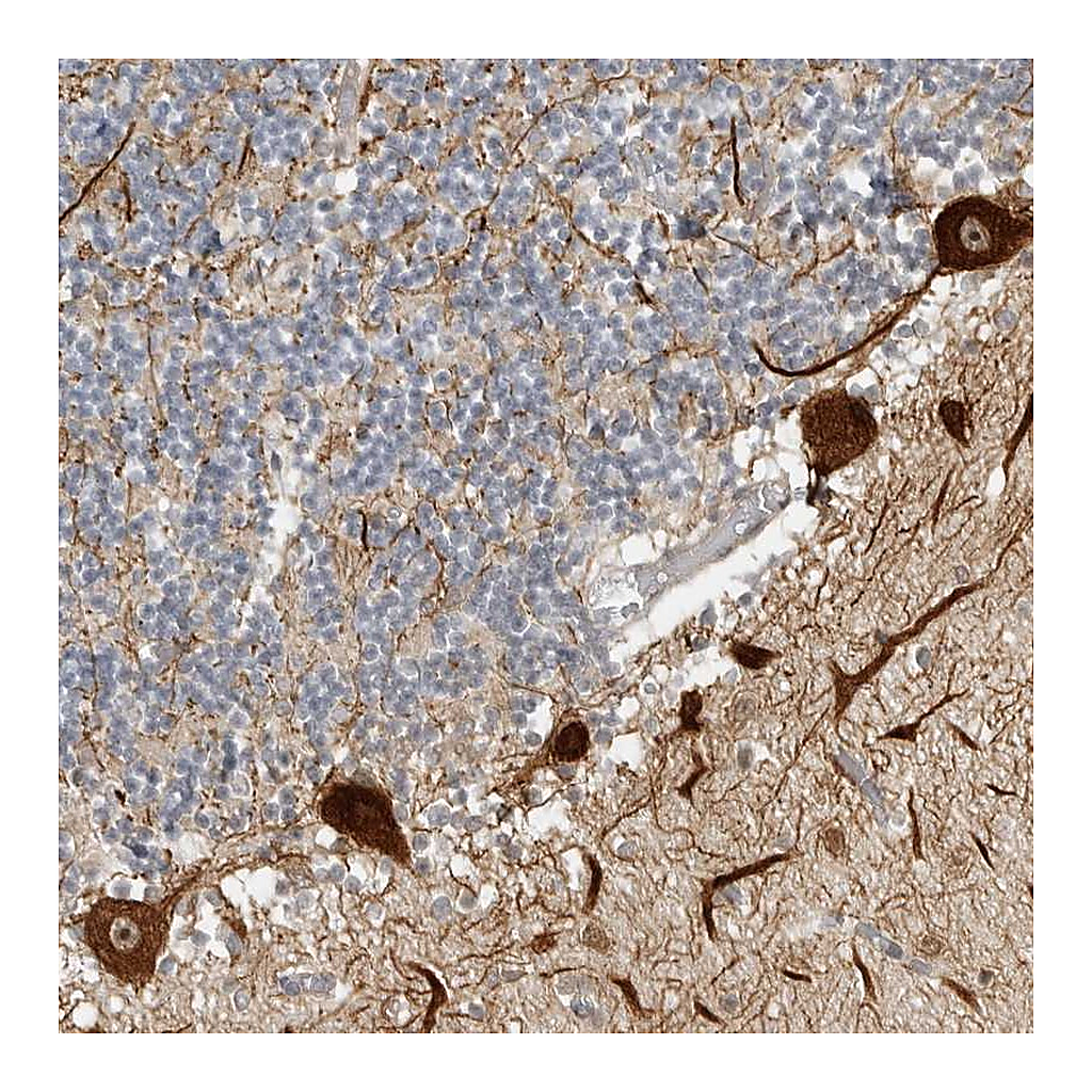 Atlas Antibodies Anti-CEP295NL Antibody