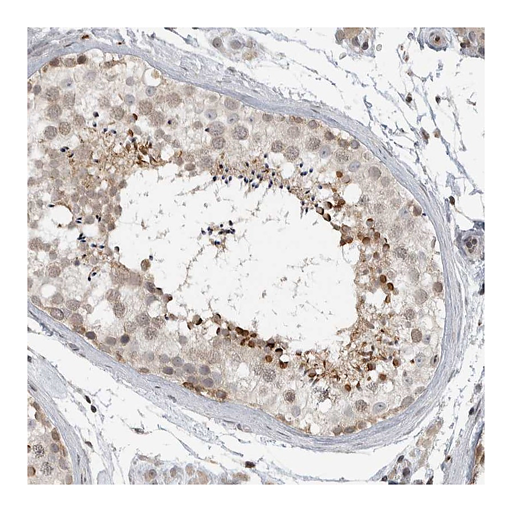 Atlas Antibodies Anti-CEP295NL Antibody