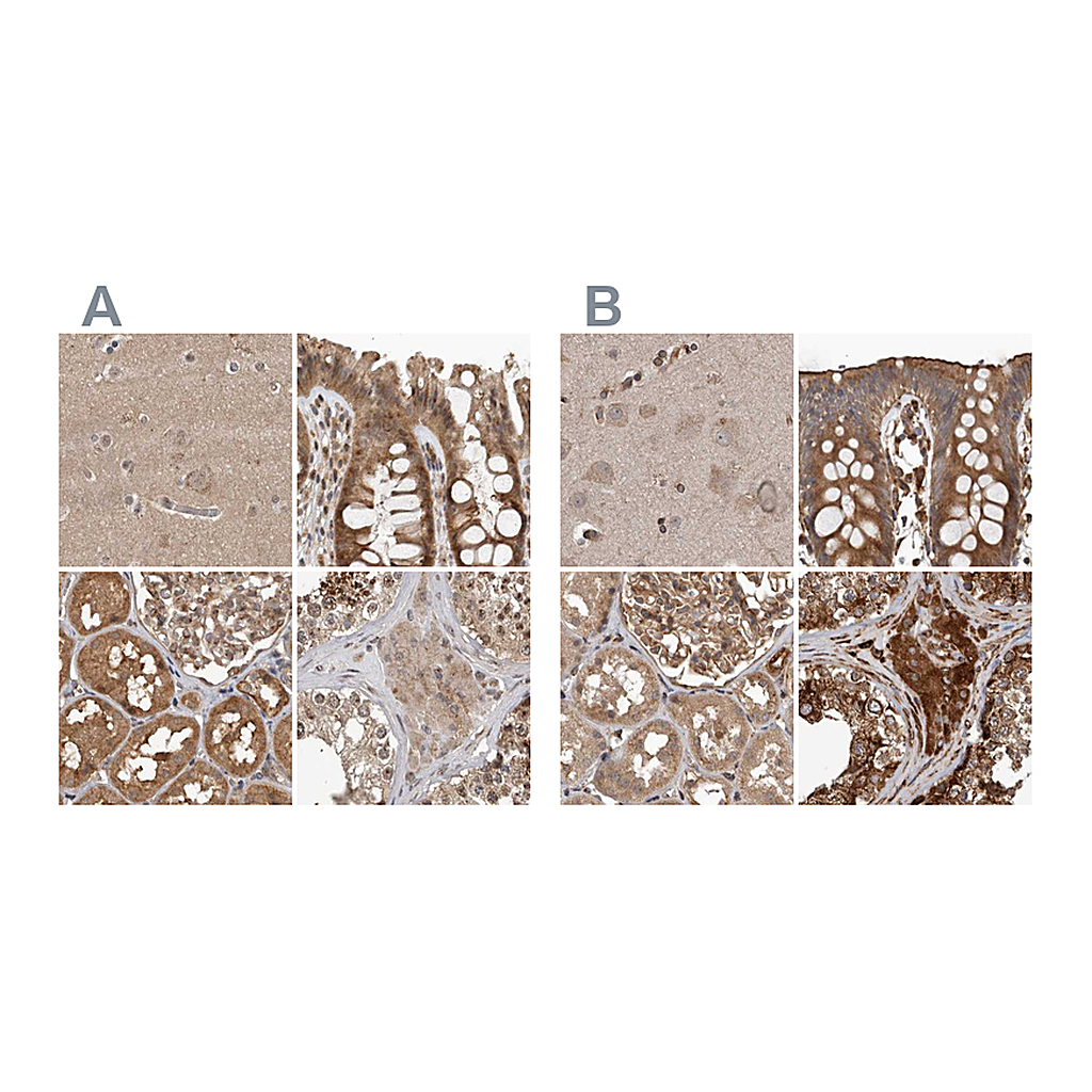 Atlas Antibodies Anti-CEP350 Antibody