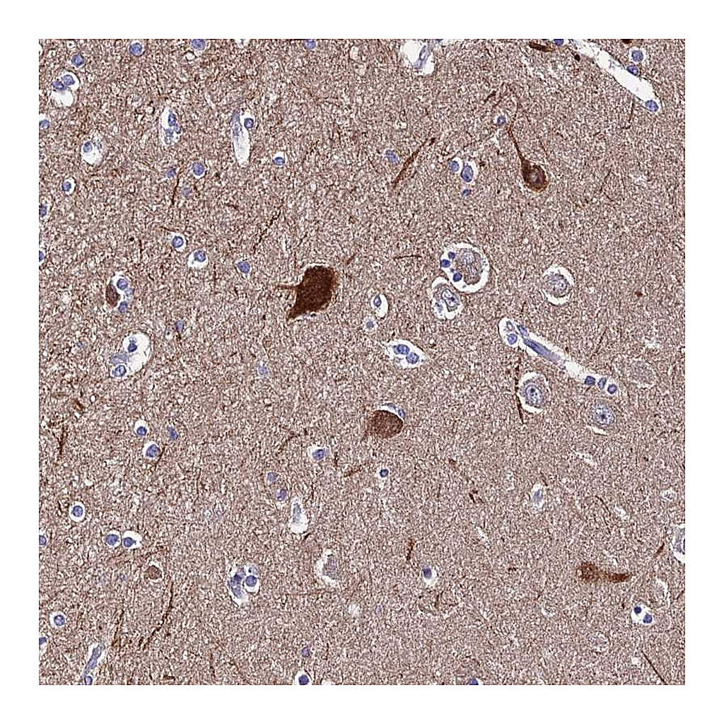 Atlas Antibodies Anti-CEP41 Antibody