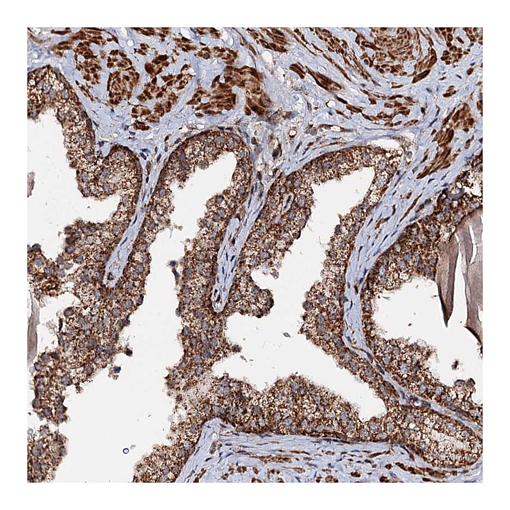 Atlas Antibodies Anti-CEP76 Antibody