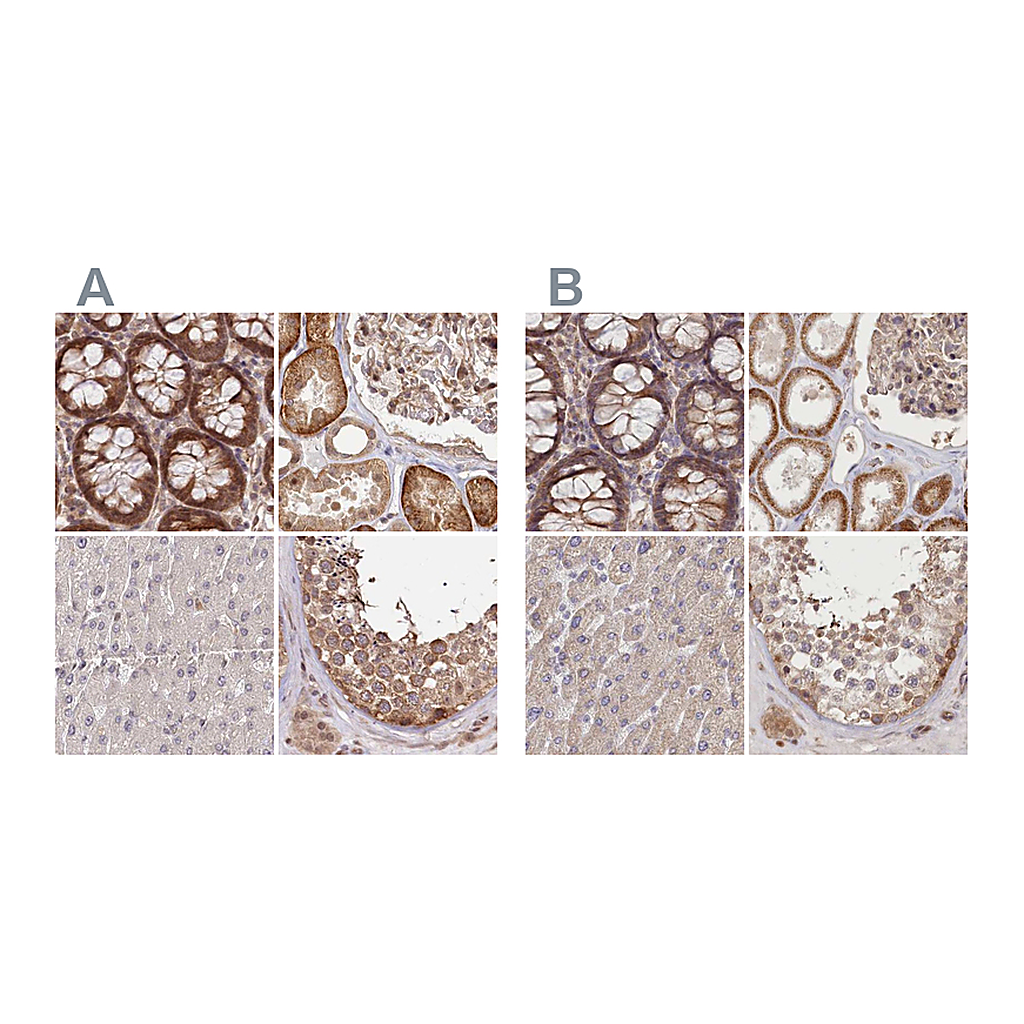 Atlas Antibodies Anti-CEP70 Antibody