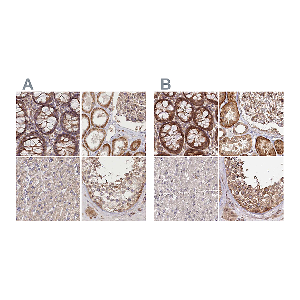 Atlas Antibodies Anti-CEP70 Antibody