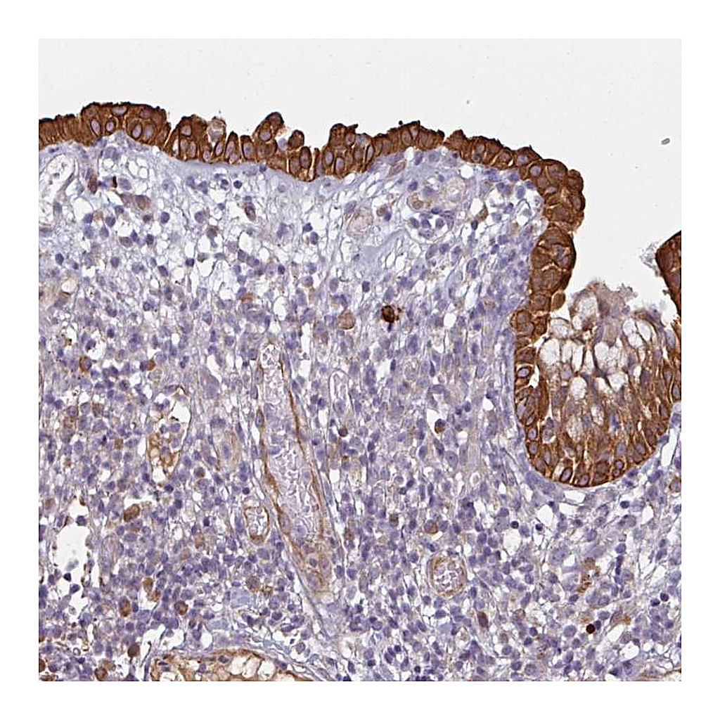 Atlas Antibodies Anti-CEP78 Antibody