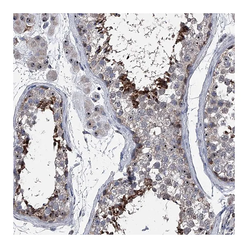 Atlas Antibodies Anti-CEP85L Antibody