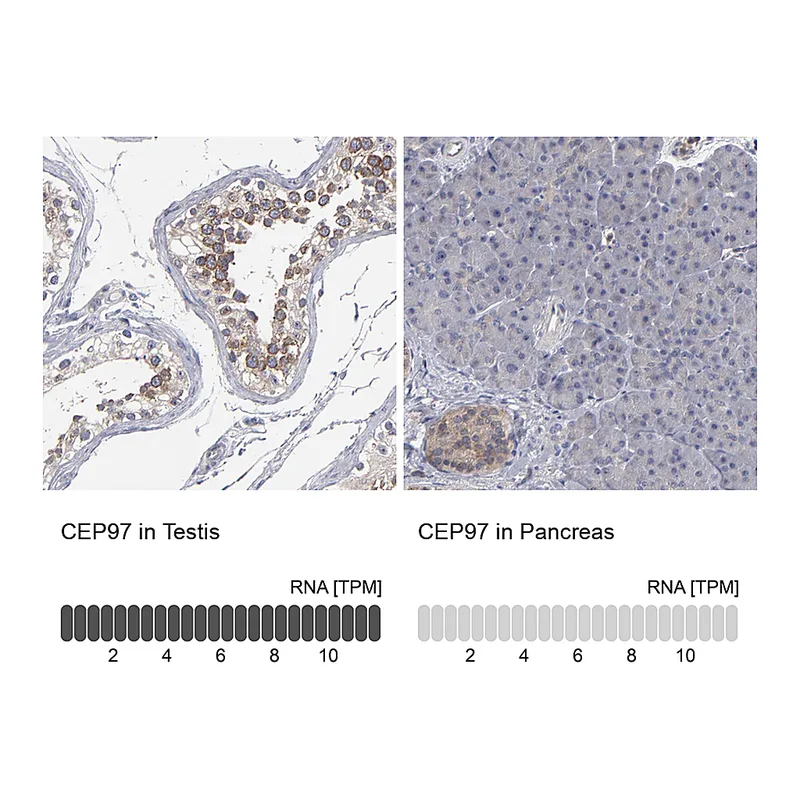 Atlas Antibodies Anti-CEP97 Antibody