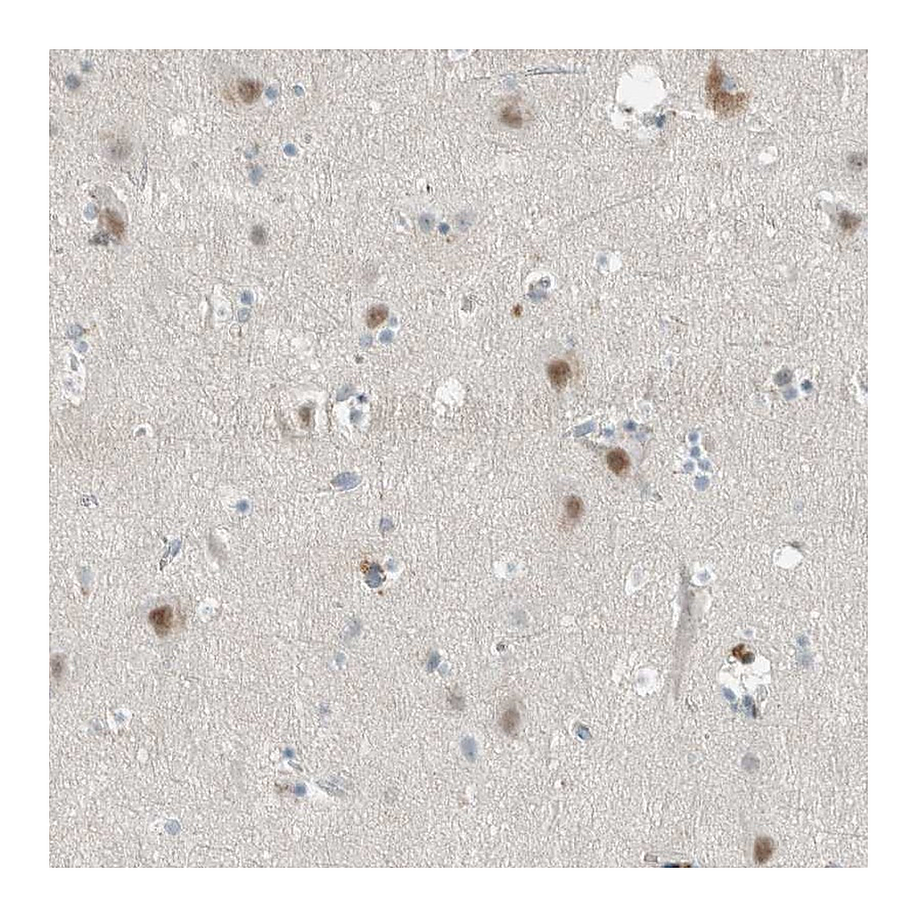 Atlas Antibodies Anti-CERCAM Antibody