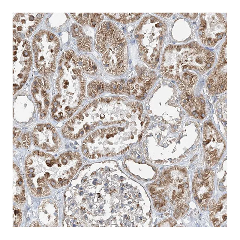 Atlas Antibodies Anti-CERKL Antibody