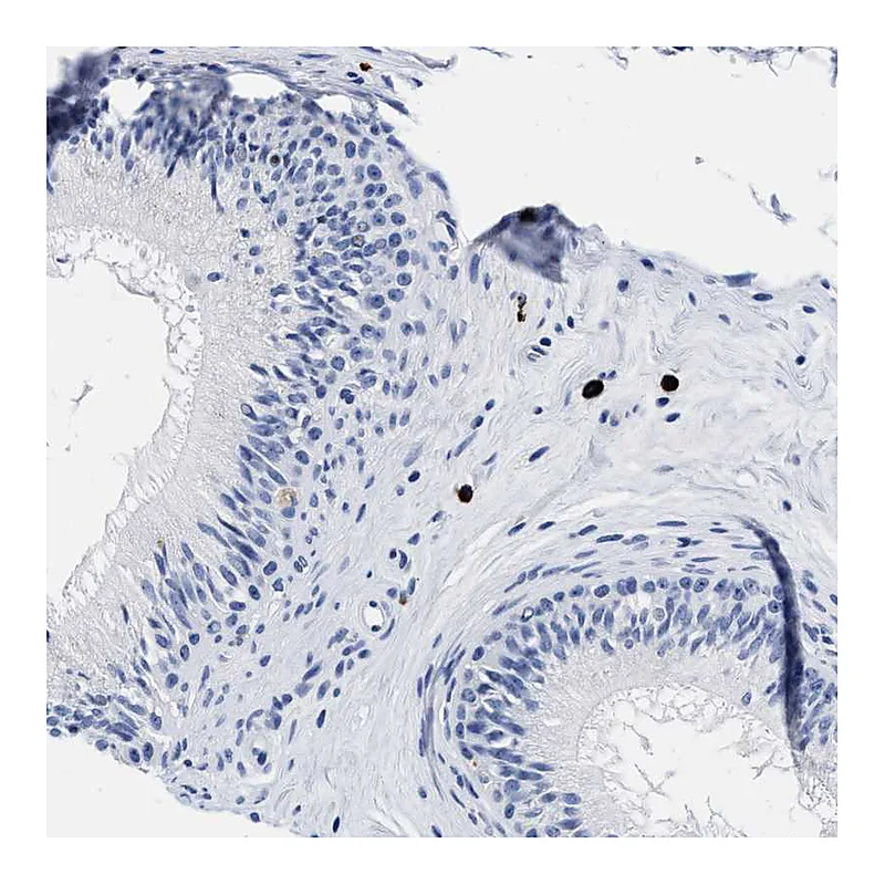 Atlas Antibodies Anti-CER1 Antibody
