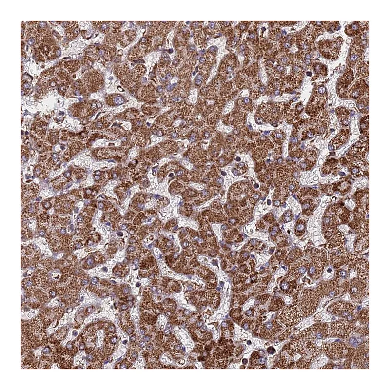 Atlas Antibodies Anti-CES5A Antibody