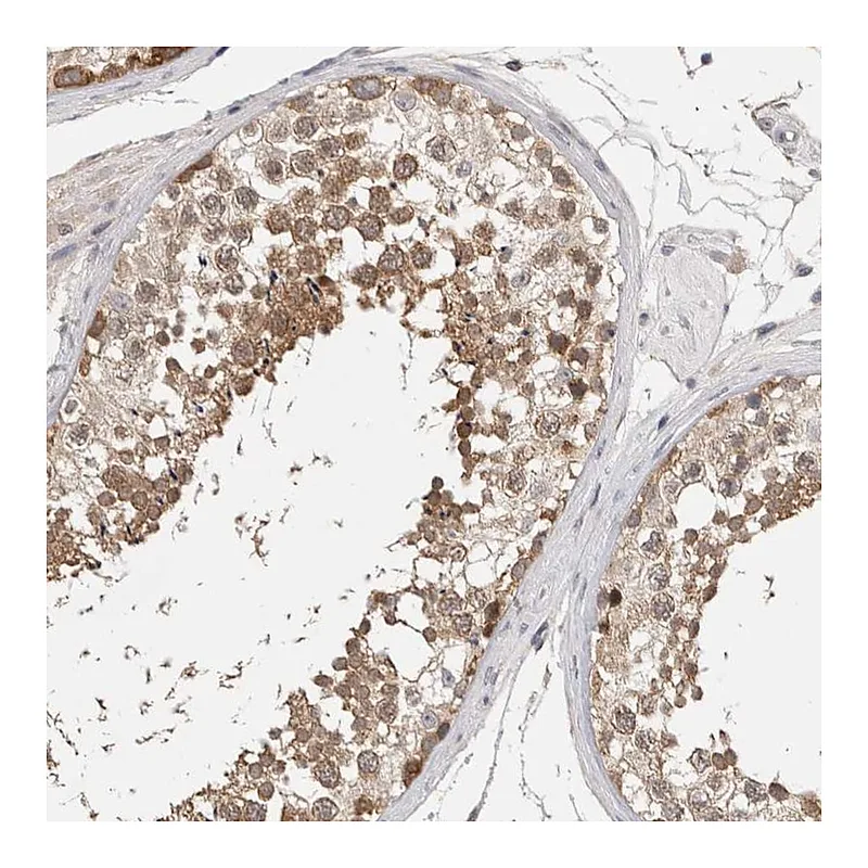 Atlas Antibodies Anti-CERS3 Antibody