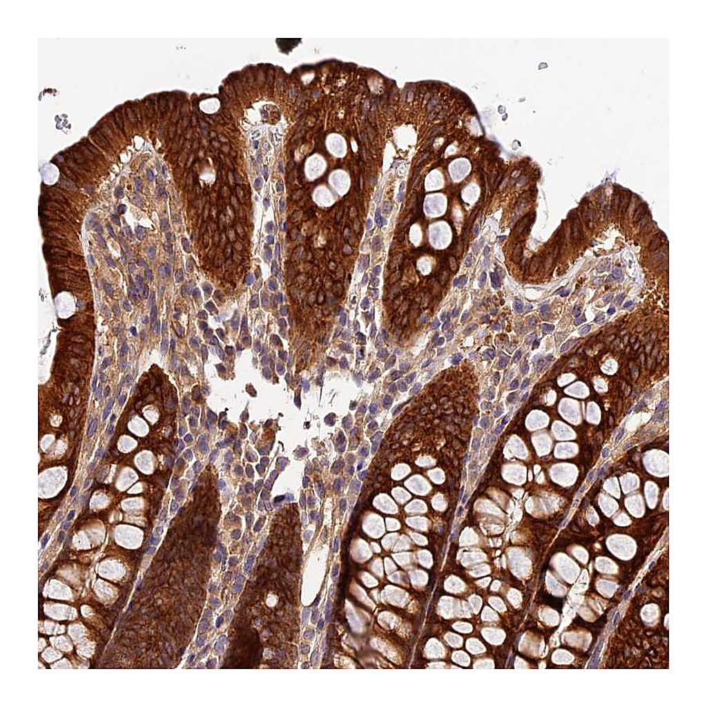 Atlas Antibodies Anti-CES3 Antibody